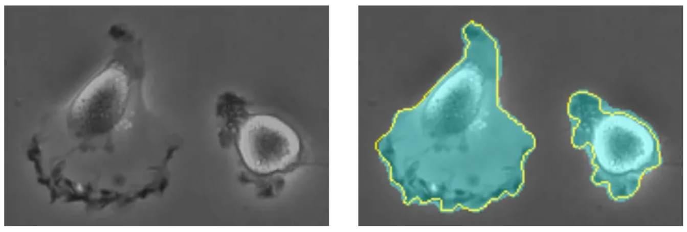 细胞图像分割